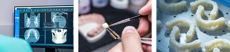 원내 디지털 기공실 보유