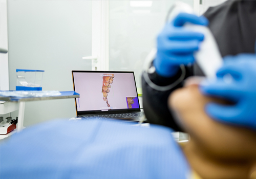 라미네이트 디자인 및 제작